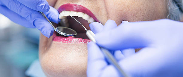 Emergency Dental Filling Replacement in TN